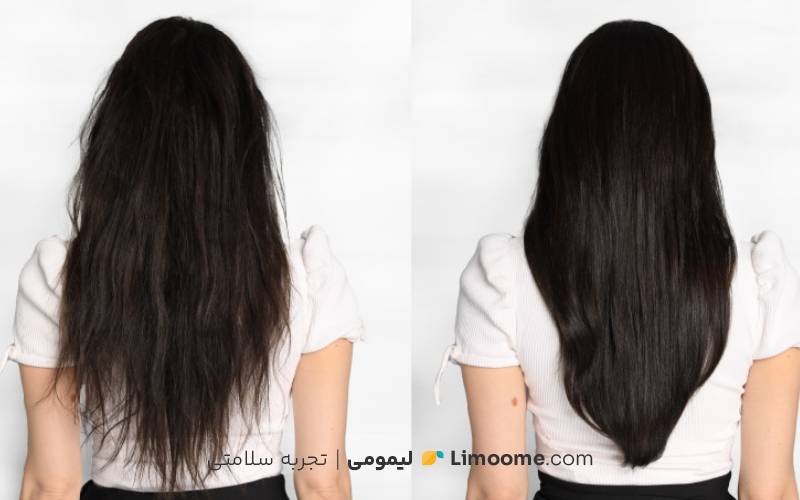 خواص پوست انار