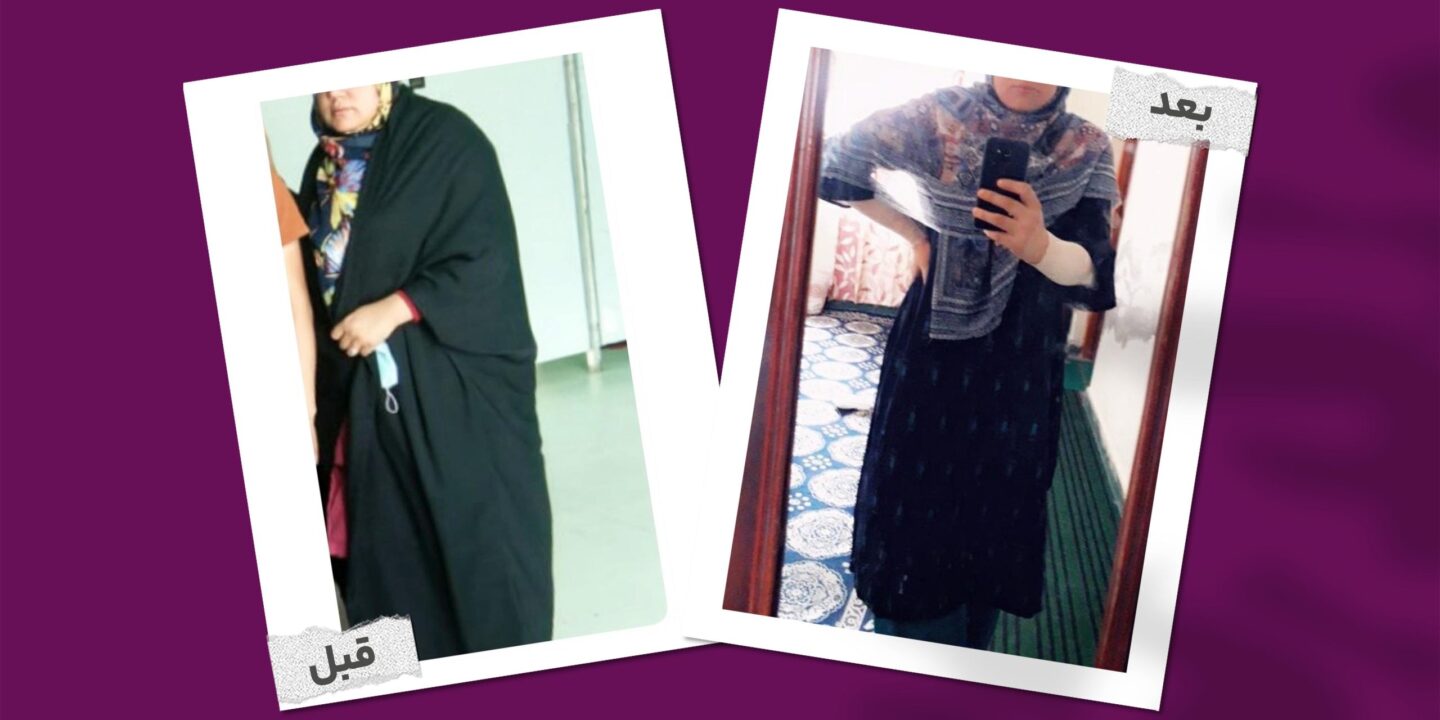 کاهش وزن ۶ کیلویی و درمان کلسترول خون رقیه با رژیم‌ لیمومی