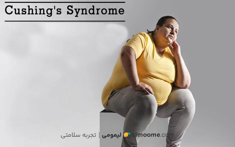 سندروم کوشینگ چیست؟
